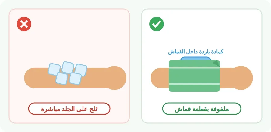 الطريقة الصحيحة: كمادة باردة ملفوفة بقطعة قماش على الذراع، والطريقة الخاطئة: ثلج على الجلد مباشرة